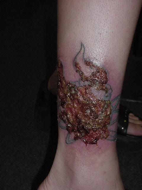 Infected Tattoo In Bakersfield,California